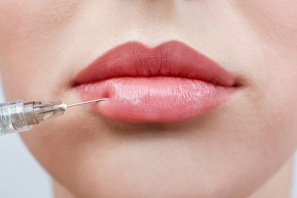 Lip fillers being injected