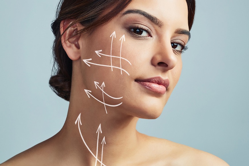 Profhilo treatment explained